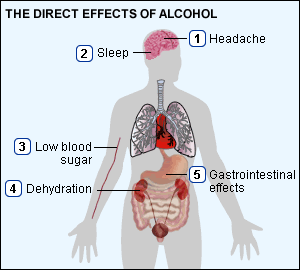 Alkohol – rizici i posledice